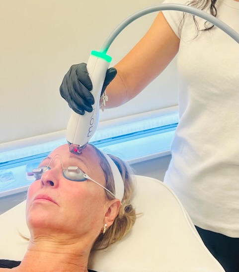MOXI BBL HEROic laser and light therapy, skin rejuvenation, Look Timeless medical spa, Markham, Ontario